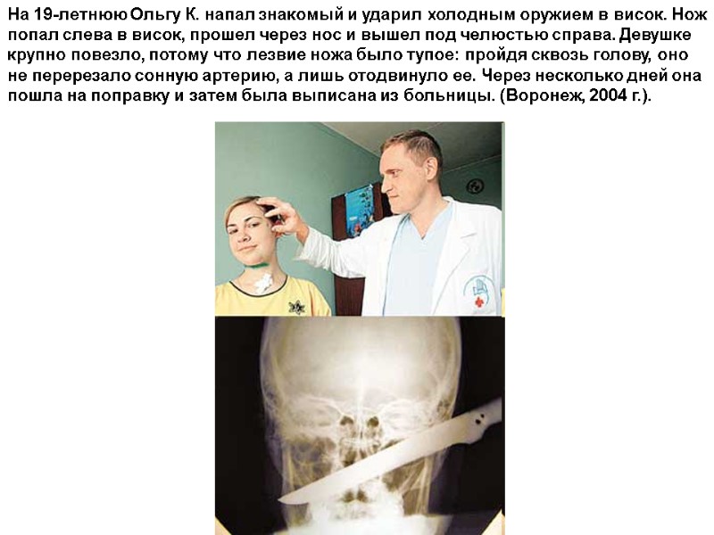 На 19-летнюю Ольгу К. напал знакомый и ударил холодным оружием в висок. Нож попал